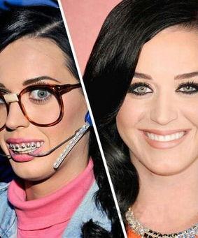 欧美整牙明星,揭秘明星美丽蜕变之路